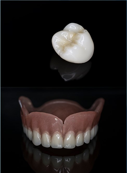 Prótesis Dentales
